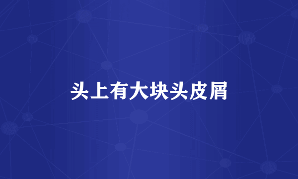 头上有大块头皮屑