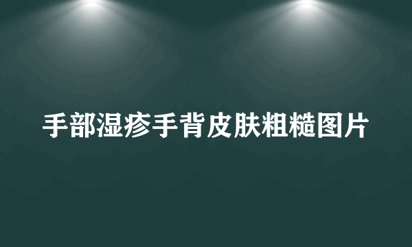 手部湿疹手背皮肤粗糙图片