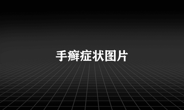 手癣症状图片