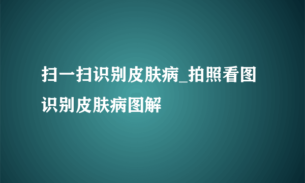 扫一扫识别皮肤病_拍照看图识别皮肤病图解