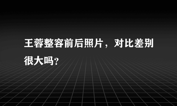 王蓉整容前后照片，对比差别很大吗？
