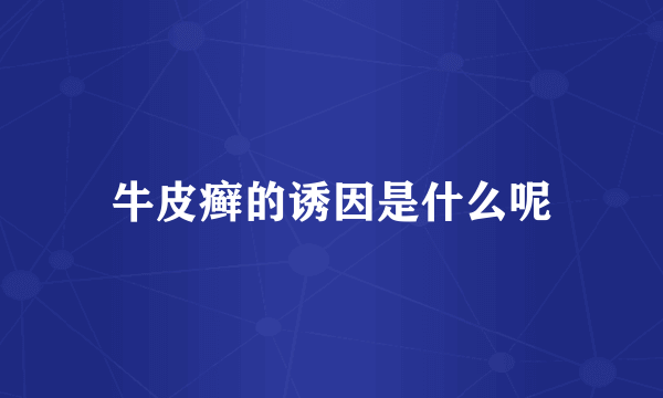 牛皮癣的诱因是什么呢