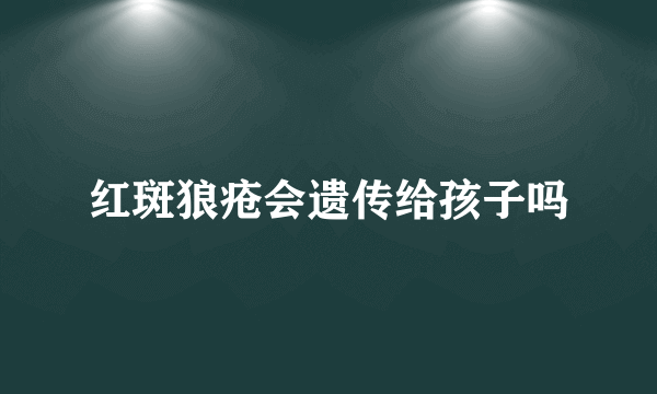 红斑狼疮会遗传给孩子吗
