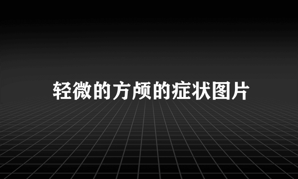  轻微的方颅的症状图片