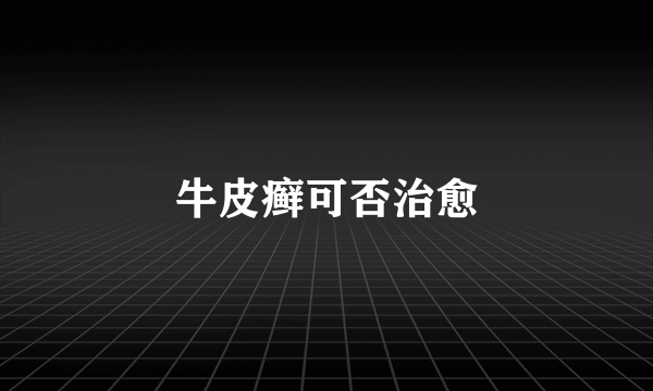 牛皮癣可否治愈
