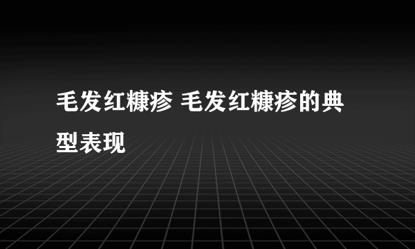 毛发红糠疹 毛发红糠疹的典型表现