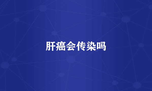 肝癌会传染吗