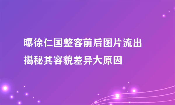 曝徐仁国整容前后图片流出    揭秘其容貌差异大原因