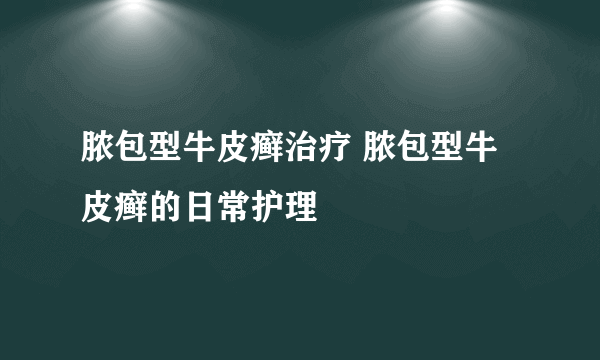 脓包型牛皮癣治疗 脓包型牛皮癣的日常护理